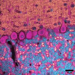 Marquage du cervelet (cyan: noyaux des cellules, jaune: protéine vGlut1, magenta: marquage de toutes les protéines)