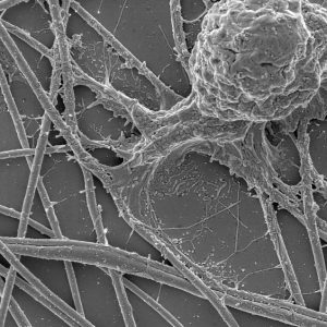 Neurone sur fil de soie - microscopie électronique à balayage