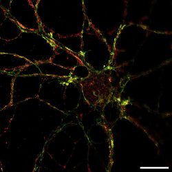 Neurone marqué par immunofluorescence, super-résolution STED

barre d'échelle: 10 µm