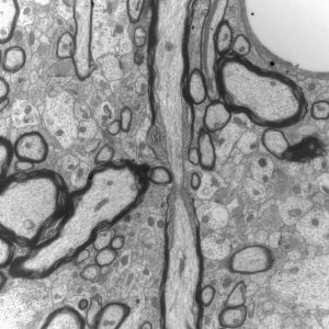 Noeuds de Ranvier dans le cortex de souris - microscopie électronique à transmission