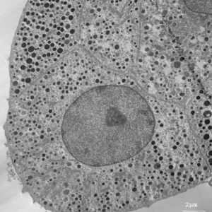 cellule chromaffine de boeuf - microscopie électronique à transmission