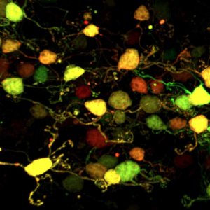 Cellules en grain exprimant des protéines fluorescentes dans le cervelet de souris