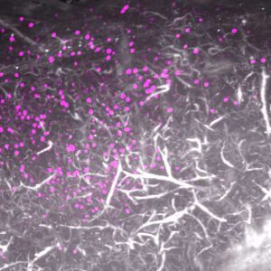 Moelle épinière de souris (blanc) avec des cellules infectées par un virus (en magenta)