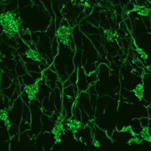 Rosettes de fibres moussues exprimant la GFP dans le cervelet de souris